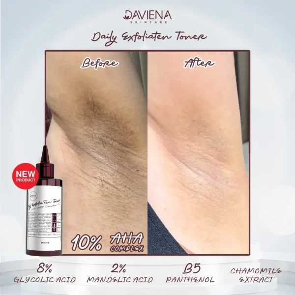 Daily Exfoliaten Toner With AHA Complex